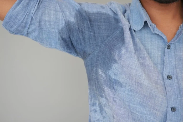 Los tratamientos avanzados permiten reducir hasta un 70% la hiperhidrosis axilar