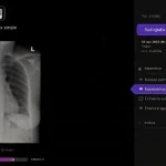 Telefónica Tech y Harrison.ai se alían en España para aplicar IA al diagnóstico en radiografías de tórax