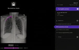 Telefónica Tech y Harrison.ai se alían en España para aplicar IA al diagnóstico en radiografías de tórax